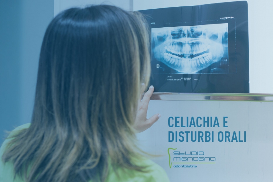 Celiachia: quando la bocca può essere un campanello d’allarme.