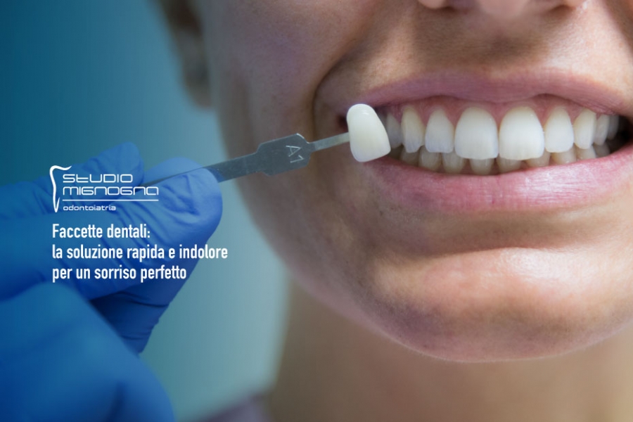 Faccette Dentali, migliora l'aspetto estetico del tuo Sorriso