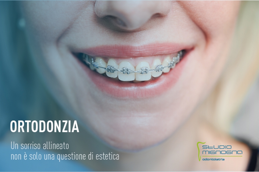 Ortodonzia: un sorriso allineato non è solo una questione di estetica